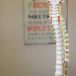 As we age, the discs in our spine – which act as cushions or “shock absorbers” between the vertebrae – dry out and shrink, a process known as degenerative disc disease.